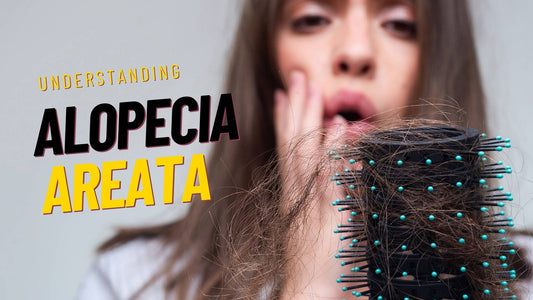 alopecia areata hair loss
