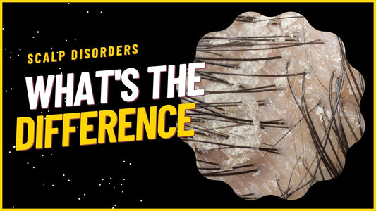 Scalp Disorders Dry Scalp