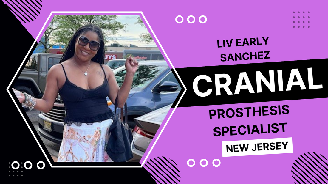 Liv Early Sanchez: Cranial Prosthesis Specialist Jersey City,  New Jersey