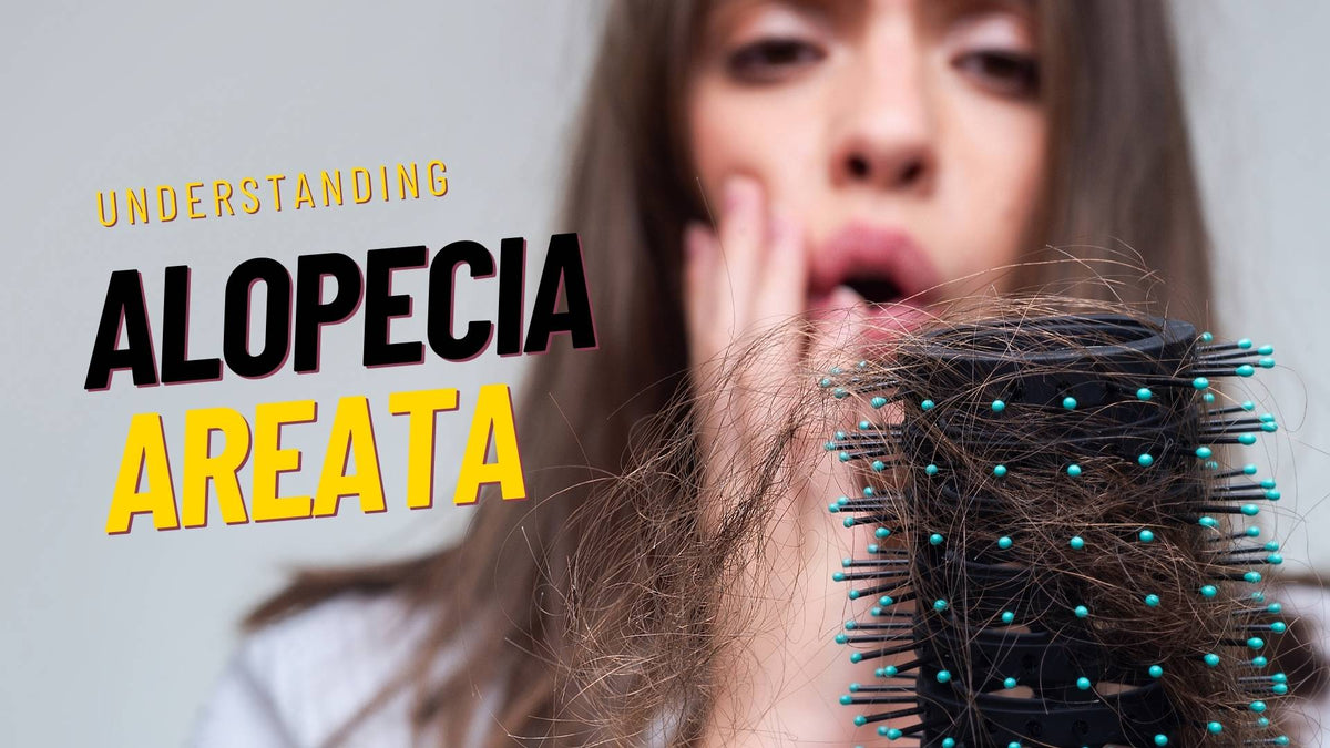 alopecia areata hair loss