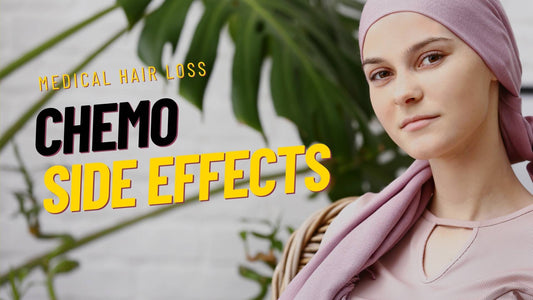 Medical Hair Loss from Chemo