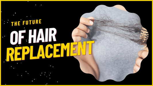 the future of hair replacement