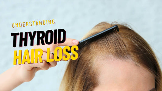 hair loss thyroid problems