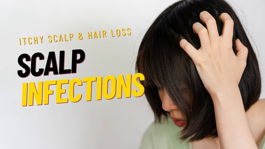 itchy scalp infections causes hair loss