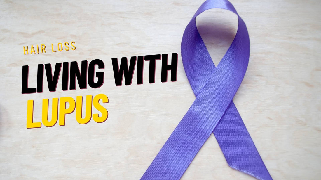 Lupus and Hair Loss