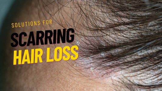 scarring hair loss