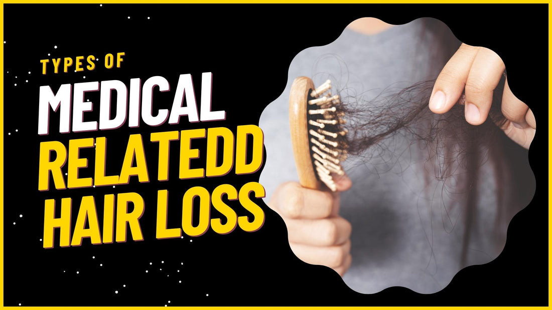Types of Medical Related Hair Loss