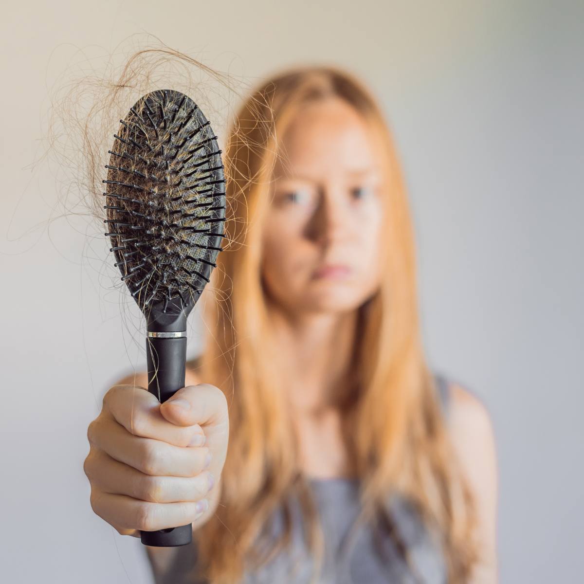 Telogen Effluvium hair loss