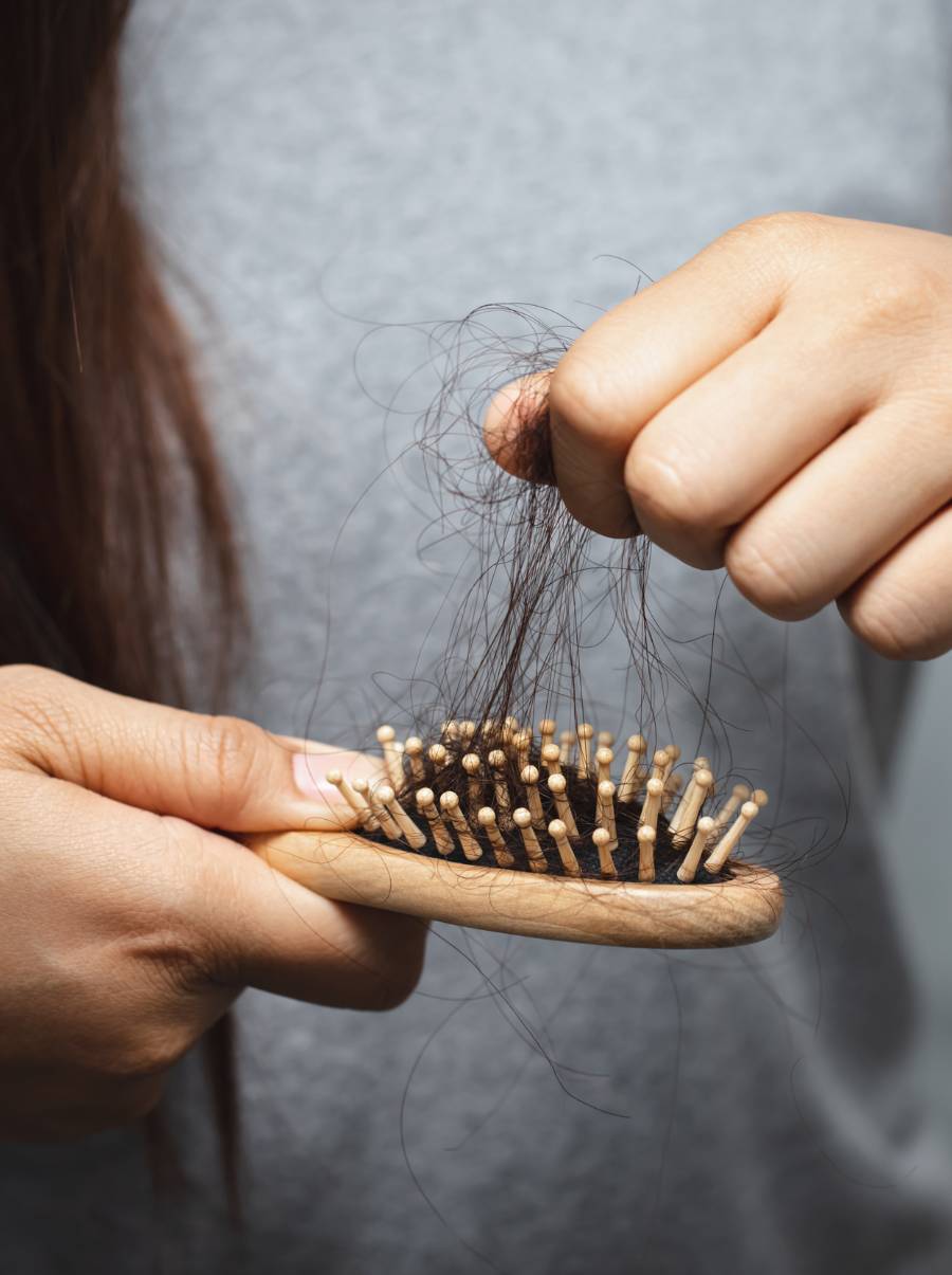 medical related hair loss